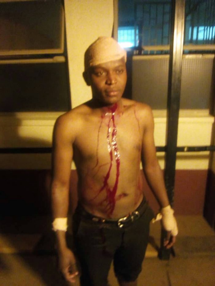 Makerere Bazaar: Student Severely injured Trying to rescue Mitchel hall speaker from Angry Mob