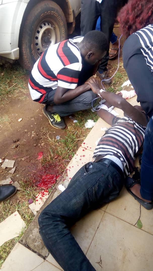 Kyambogo University Student Loses Hand in Strike